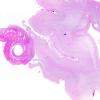 13E0 (Case 13) C