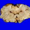 8B Holoprosencephaly (Case 8) gross1a - CopyA