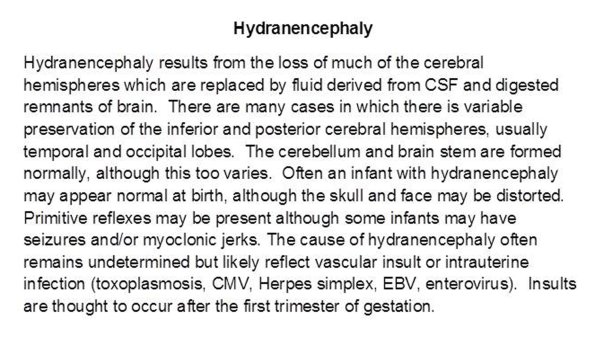 0A Hydranencephaly text