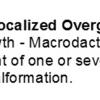 0A Localized Overgrowth - Macrodactyly