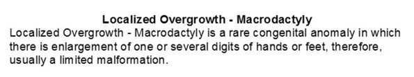 0A Localized Overgrowth - Macrodactyly