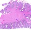 8A1 Heterotopia, cerebellum (Case 8) H&E whole mountA