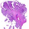 9A1 Malformations, cerebellar (Case 9) H&E whole mount