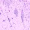 5B4E Malformation (Case 5) A7 H&E 4X 2