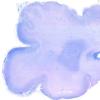 5C1 Malformation (Case 5)  LFB-PAS WM 2