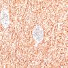 5H4 Malformation (Case 5) A7 NF 20X 2