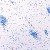 5I4 Malformation (Case 5) NeuN 20X 1