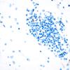 5I5 Malformation (Case 5) NeuN 40X 1