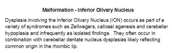 0A Malformation - Inferior Olivary Nucleus