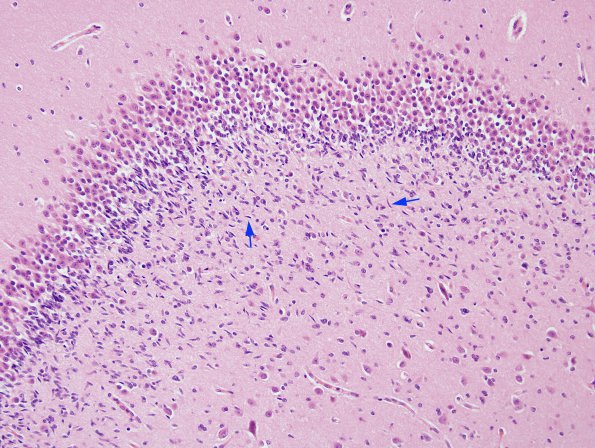 3A2 Dentate Immature cells (Case 3) H&E 2