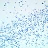 3B Dentate Immature cells (Case 3) CD163 1A