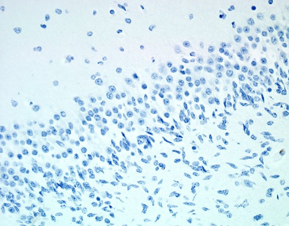 3B Dentate Immature cells (Case 3) CD163 1A