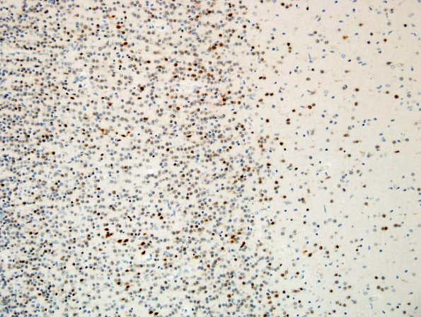 5B3 Maturation Cortex, 26 wks (Case 5) N5 NeuN 20X