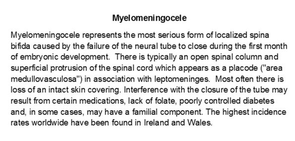 0A Myelomeningocele A