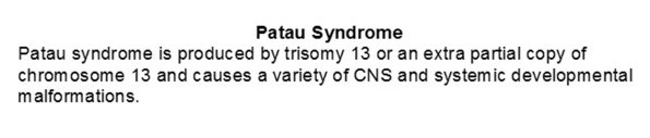 A0 Patau Syndrome - Text