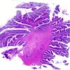 1B2 Patau Syndrome (Case 1) N9 H&E whole mount