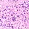 1B6 Patau Syndrome, dentate nucleus (Case 1) N9 H&E 1