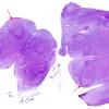 1C1 Patau Syndrome (Case 1) ION medulla H&E whole mount