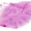 9B1 Polymicrogyria (Case 9) H&E whole mount