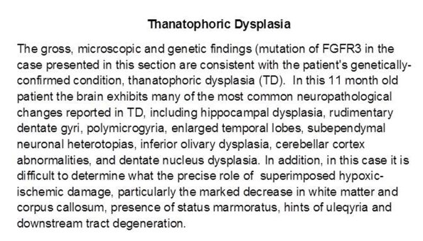 0A Thanatophoric Dysplasia - Text