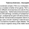 0A Tuberous Sclerosis Text