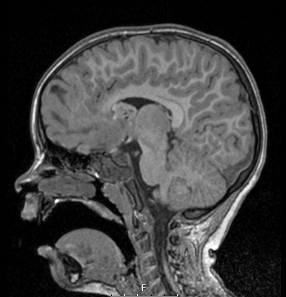 16A2 TS & SEGA (Case 16) T1noC - Copy