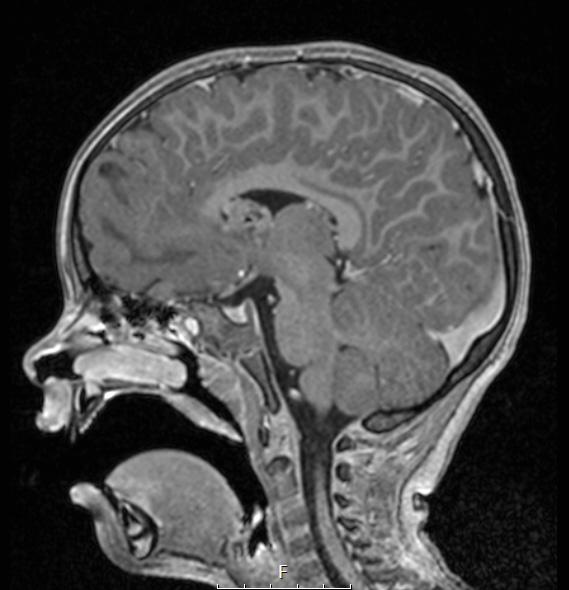 16A3 TS & SEGA (Case 16) T1W - Copy