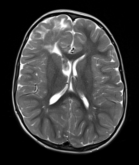 16A5 TS & SEGA (Case 16) T2W A - Copy