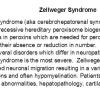 0A Zellweger Syndrome - Text