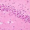 1B8 Dentate Malformation, unilateral (Case 6) non-affected side N11 H&E 2