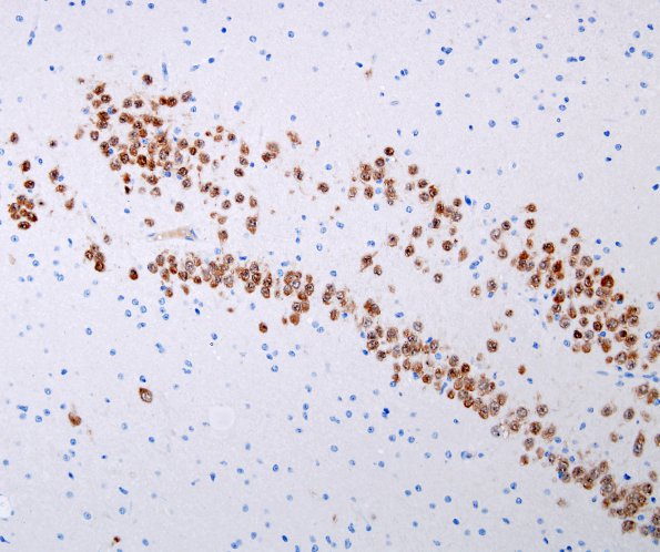 3B3 Dentate malformation, duplication (Case 2) NeuN 2