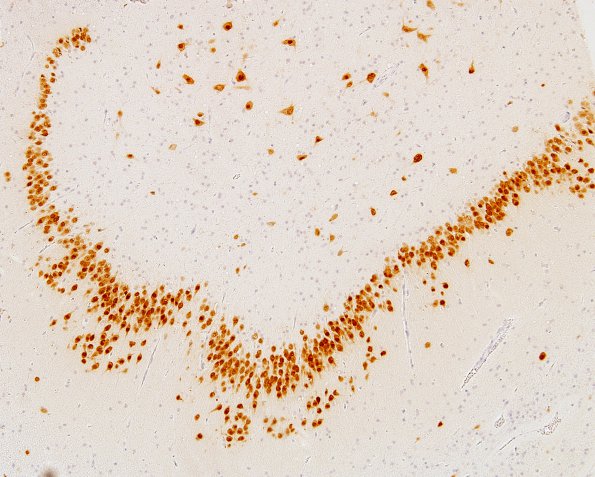 4B1 Dentate malformation, duplication (Case 3) NeuN