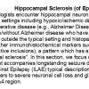 0 Hippocampal Sclerosis - Text A