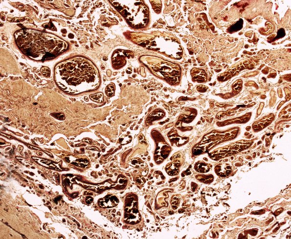 1C1 PseudoAVM (Case 1) VVG 2