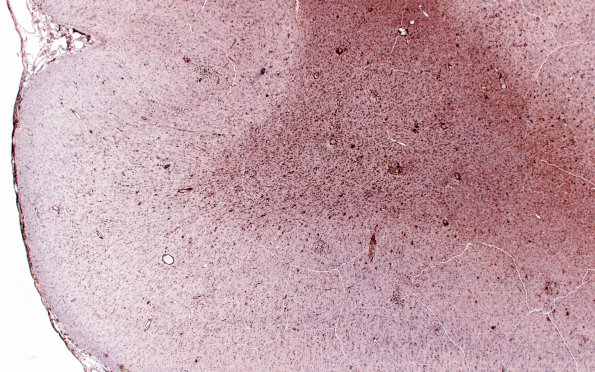 9B1 Rasmussen's (Case 9) LCA 8