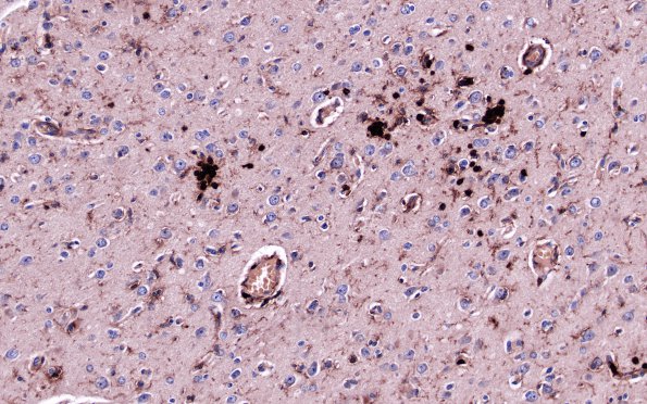 9B3 Rasmussen's (Case 9) LCA 1