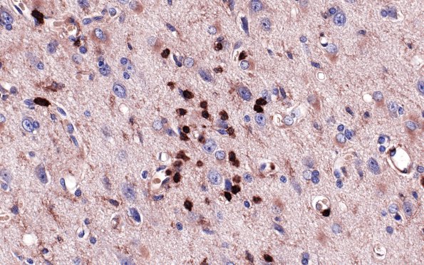 9B4 Rasmussen's (Case 9) LCA 2