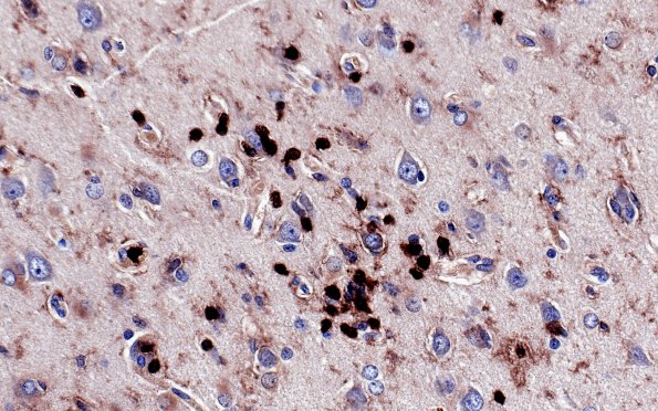 9B5 Rasmussen's (Case 9) LCA 9