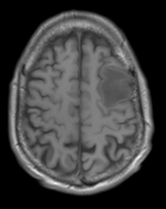 5A2 (Case 5)  T1noC - Copy