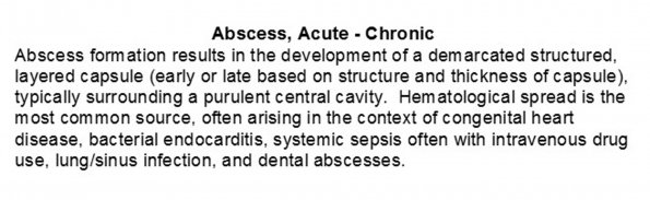 0A Abscesses, Subacute - Chronic