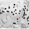 2C Bacteria  (Case 2) EM 001 copy - Copy