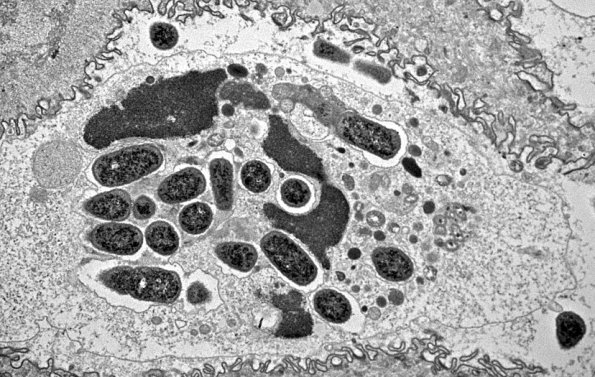 2D Bacteria, cilia EM 002 - Copy - Copy