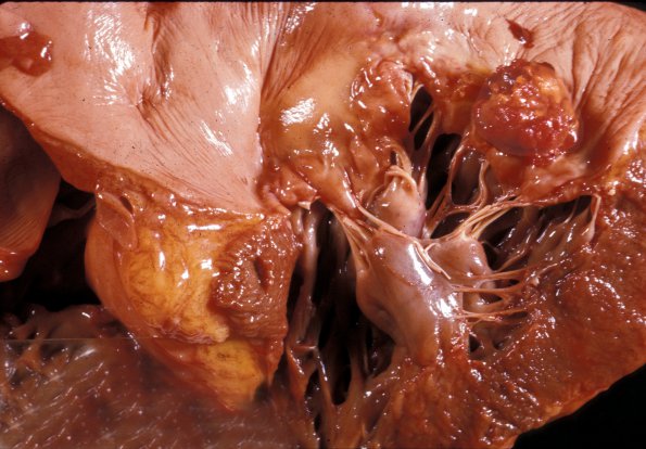 4D Abscess, sources