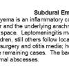 0A Subdural Empyema - Text A