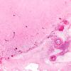 16A2 Meningitis & arteritis (Case 16) H&E 2X 1