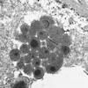 1J6 Mycoplasma (Case 1) EM 020 - Copy