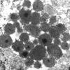 1J8 Mycoplasma (Case 1) EM 024 - Copy