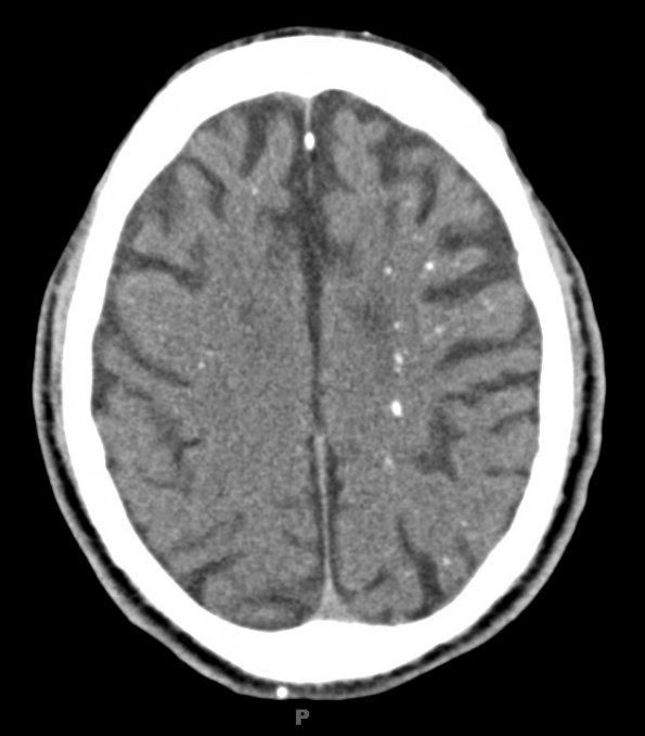 2A1 (Case 2) CT 10-3-2012 CT 14of34 3