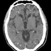 2A4 (Case 2) CT 10-3-2012 CT 14of34 1