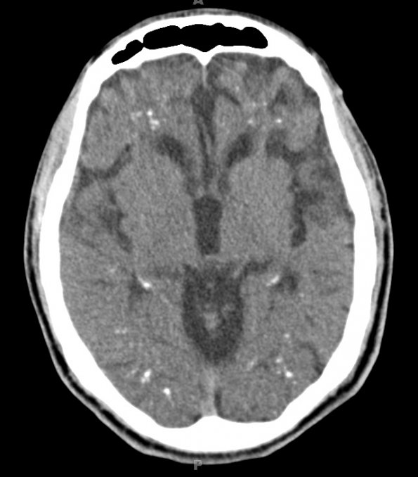 2A4 (Case 2) CT 10-3-2012 CT 14of34 1